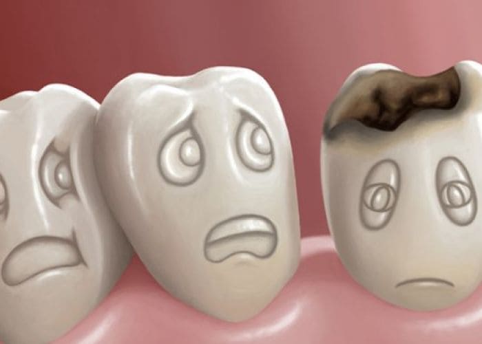 Mal de dent: Causes et massage anti-douleur